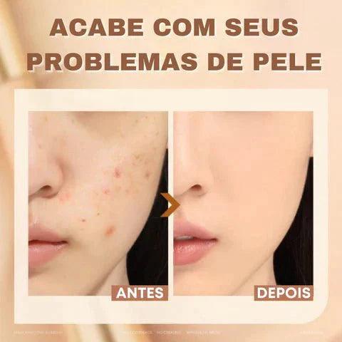 Corretivo Focallure 2 em 1 - Anti Manchas e Rejuvenescedora - Serena Beauty