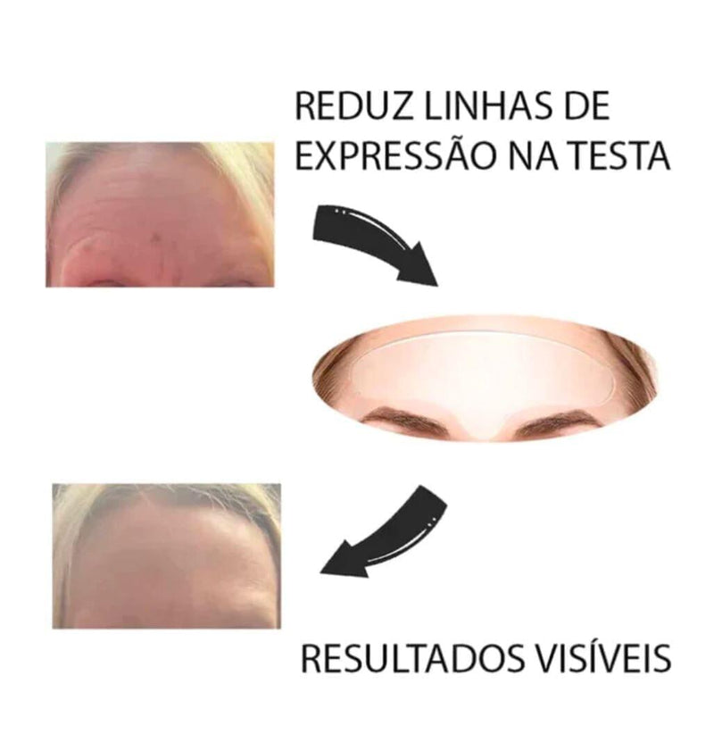 Adesivo Anti Rugas - Nature Botox - Livre de rugas e linhas de expressões! - Serena Beauty